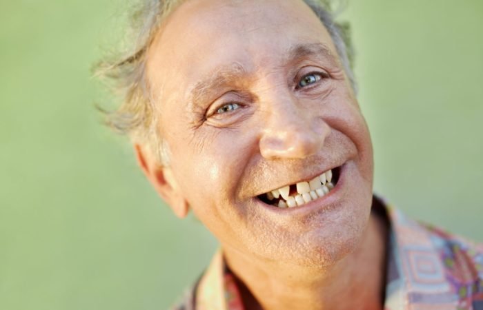 portrait of senior caucasian man with dental problems showing missing tooth and smiling. Horizontal shape, copy space